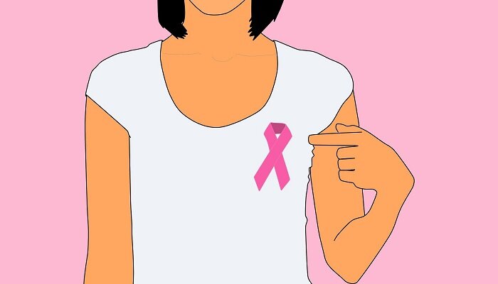 70% de mujeres con cáncer de mama pueden evitar quimioterapia