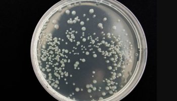 Resistente superbacteria C. Auris se propaga a nivel global