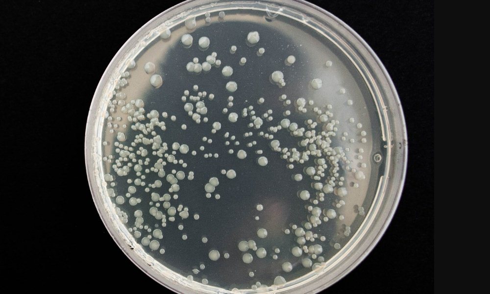Resistente superbacteria C. Auris se propaga a nivel global.