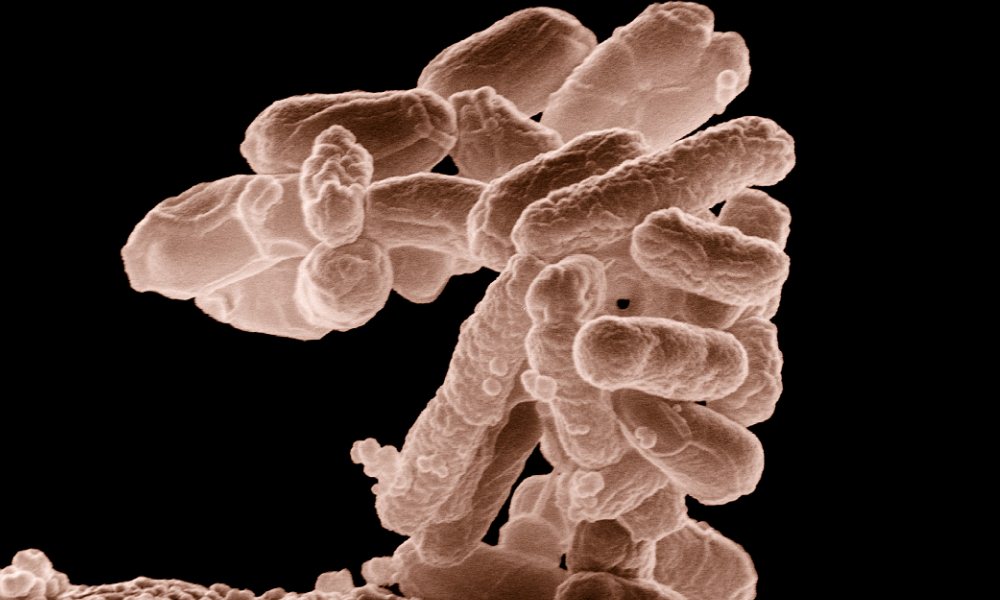 Brote de E. coli enferma a 72 personas en 5 estados.