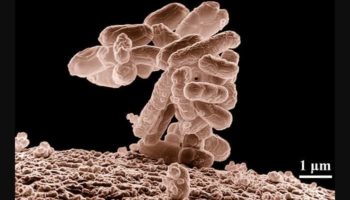 Brote de E. coli enferma a 17 personas en ocho estados