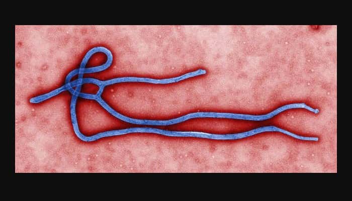 La FDA aprueba la primera vacuna contra el ébola.